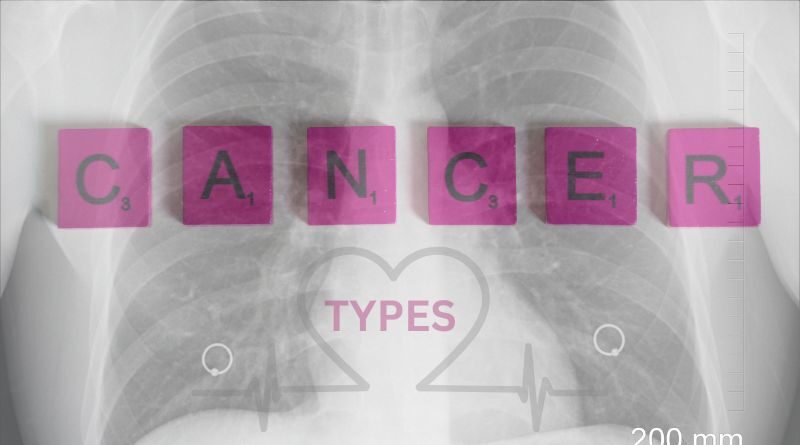 Types of Cancer and Symptoms You Need to Know